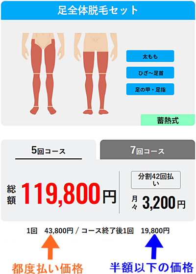 メンズリゼ 都度払い 足全体脱毛