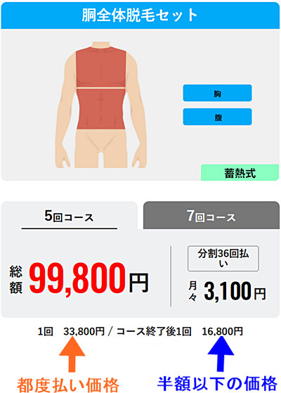 メンズリゼ 都度払い 胴全体脱毛