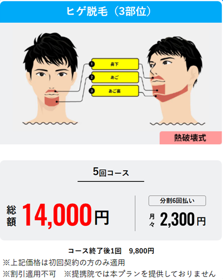 メンズリゼ ヒゲ脱毛