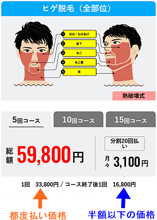 メンズリゼ ヒゲ全体脱毛