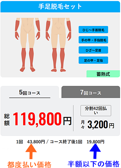 メンズリゼ 都度払い 手足脱毛