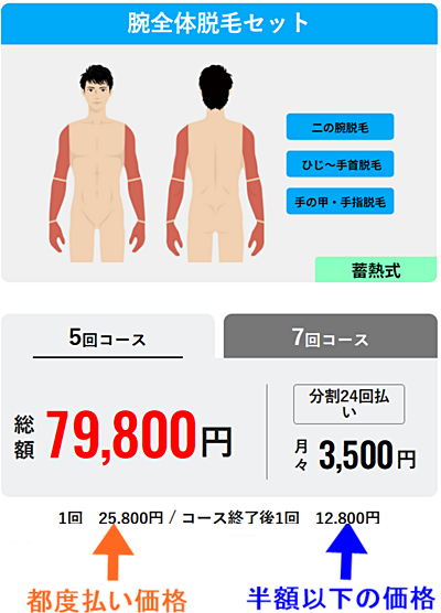 メンズリゼ 都度払い 腕全体脱毛